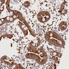 Immunohistochemical staining of human small intestine shows strong cytoplasmic positivity in glandular cells.