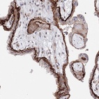 Anti-C11orf52 Antibody