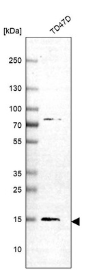 Western blot analysis in human cell line TD47D.