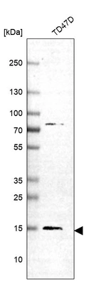 Western blot analysis in human cell line TD47D.