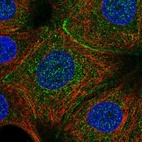 Immunofluorescent staining of human cell line MCF7 shows localization to cell junctions.