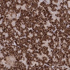 Anti-TGFBRAP1 Antibody