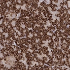 Anti-TGFBRAP1 Antibody