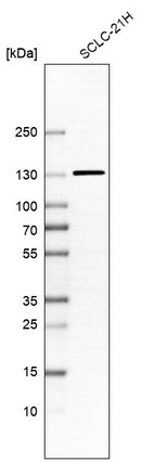 Western blot analysis in human cell line SCLC-21H.