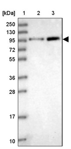 Lane 1: Marker [kDa] 250, 130, 95, 72, 55, 36, 28, 17, 10_br/_Lane 2: Human cell line RT-4_br/_Lane 3: Human cell line U-251MG sp