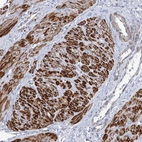 Anti-ARSI Antibody