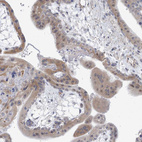 Immunohistochemical staining of human placenta shows moderate cytoplasmic positivity in trophoblastic cells.