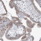 Immunohistochemical staining of human placenta shows moderate cytoplasmic positivity in trophoblastic cells.