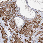Immunohistochemical staining of human prostate shows strong cytoplasmic positivity in smooth muscle cells.
