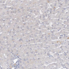 Immunohistochemical staining of human liver shows no positivity in hepatocytes as expected.