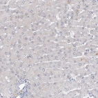 Immunohistochemical staining of human liver shows no positivity in hepatocytes as expected.