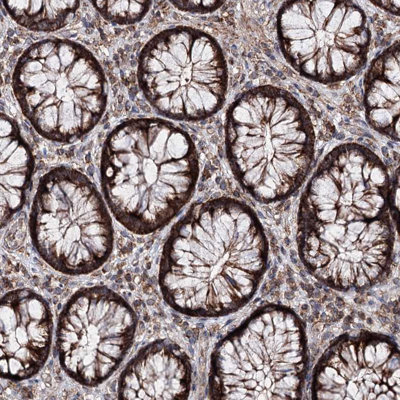 Anti-MINDY3 Antibody