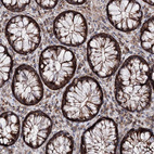 Anti-MINDY3 Antibody