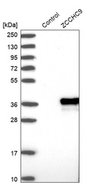 Anti-ZCCHC9 Antibody