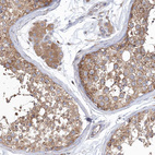 Immunohistochemical staining of human testis shows moderate granular cytoplasmic positivity in cells in seminiferous ducts.