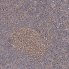 Immunohistochemical staining of human tonsil shows moderate granular cytoplasmic positivity in germinal center cells.