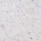 Immunohistochemical staining of human skeletal muscle shows no positivity in myocytes as expected.