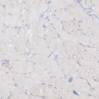 Immunohistochemical staining of human skeletal muscle shows no positivity in myocytes as expected.