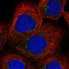 Immunofluorescent staining of human cell line A-431 shows localization to vesicles.