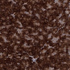 Anti-MINDY3 Antibody