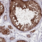 Immunohistochemical staining of human testis shows high expression.