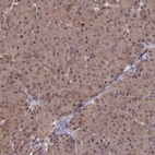 Immunohistochemical staining of human pancreas shows low expression as expected.