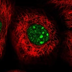 Immunofluorescent staining of human cell line A-431 shows localization to nucleus & nucleoli.