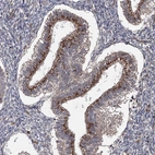Immunohistochemical staining of human endometrium shows moderate cytoplasmic positivity in glandular cells.