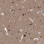 Immunohistochemical staining of human cerebral cortex shows cytoplasmic positivity in neuronal cells.