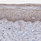 Immunohistochemical staining of human cervix, uterine shows moderate cytoplasmic positivity in squamous epithelial cells.