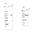 Western blot analysis using Anti-WDR48 antibody HPA038421 (A) shows similar pattern to independent antibody HPA058015 (B).