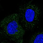 Immunofluorescent staining of human cell line A-431 shows localization to vesicles.