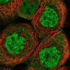 Immunofluorescent staining of human cell line A-431 shows localization to nucleoplasm & cytosol.