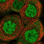 Immunofluorescent staining of human cell line A-431 shows localization to nucleoplasm & cytosol.