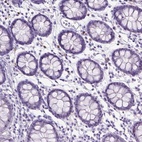 Immunohistochemical staining of human colon shows low expression as expected.