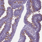 Immunohistochemical staining of human fallopian tube shows high expression.