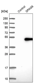 Western blot analysis in control (vector only transfected HEK293T lysate) and SPAG6 over-expression lysate (Co-expressed with a C-terminal myc-DDK tag (~3.1 kDa) in mammalian HEK293T cells, LY406761).