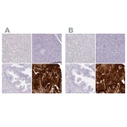 Immunohistochemical staining of human liver, pancreas, prostate and skeletal muscle using Anti-MYOZ1 antibody HPA038437 (A) shows similar protein distribution across tissues to independent antibody HPA037848 (B).