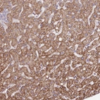 Anti-ATE1 Antibody
