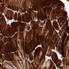 Immunohistochemical staining of human skeletal muscle shows strong cytoplasmic positivity in myocytes.