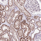Immunohistochemical staining of human kidney shows strong cytoplasmic positivity in cells in tubules.