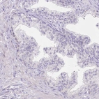 Immunohistochemical staining of human prostate shows no positivity in glandular cells as expected.