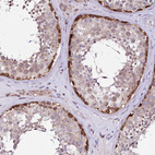 Immunohistochemical staining of human testis shows strong cytoplasmic positivity in spermatogonia.