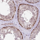 Immunohistochemical staining of human testis shows strong cytoplasmic positivity in spermatogonia.