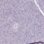 Immunohistochemical staining of human pancreas shows no positivity in exocrine glandular cells as expected.
