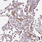 Immunohistochemical staining of human lung shows strong cytoplasmic positivity in macrophages.