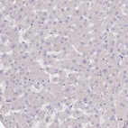 Immunohistochemical staining of human liver shows no positivity in hepatocytes as expected.