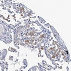 Anti-RTKN2 Antibody