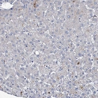 Immunohistochemical staining of human liver shows no positivity in hepatocytes as expected.