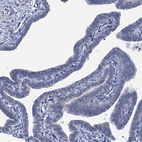 Immunohistochemical staining of human fallopian tube shows no positivity in glandular cells as expected.